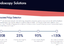 AI-Assisted Polyp Detection Device Receives FDA Clearance