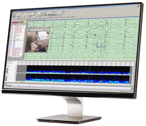 Critical Vulnerability in NeuroWorks Natus EEG Software Could Allow Cyberattacks on Hospitals