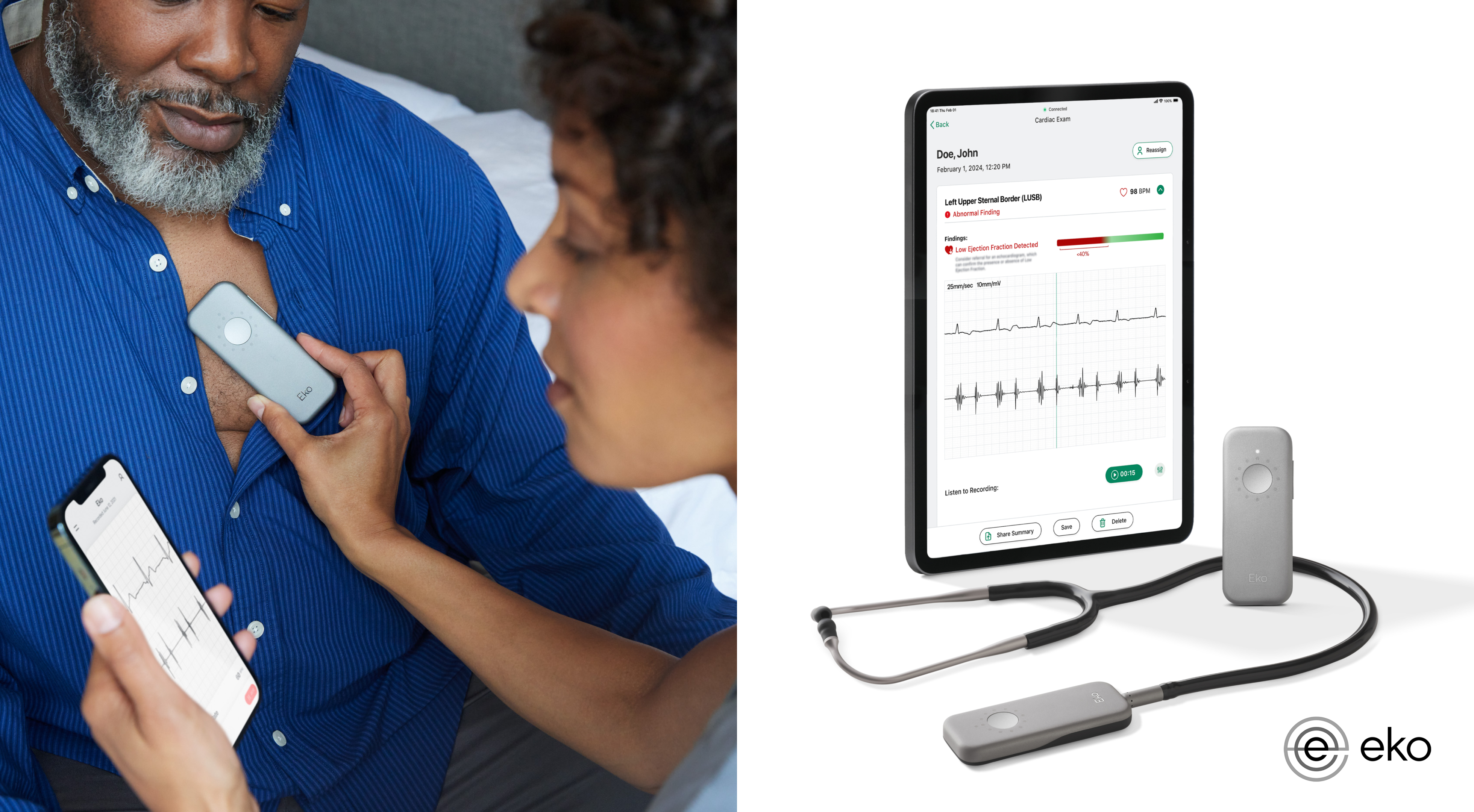 15-Second Heart Failure Test: Eko's AI Stethoscope Gets FDA Nod