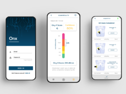 Oncoustics Raises $5M for AI-Driven Point-of-Care Diagnostics